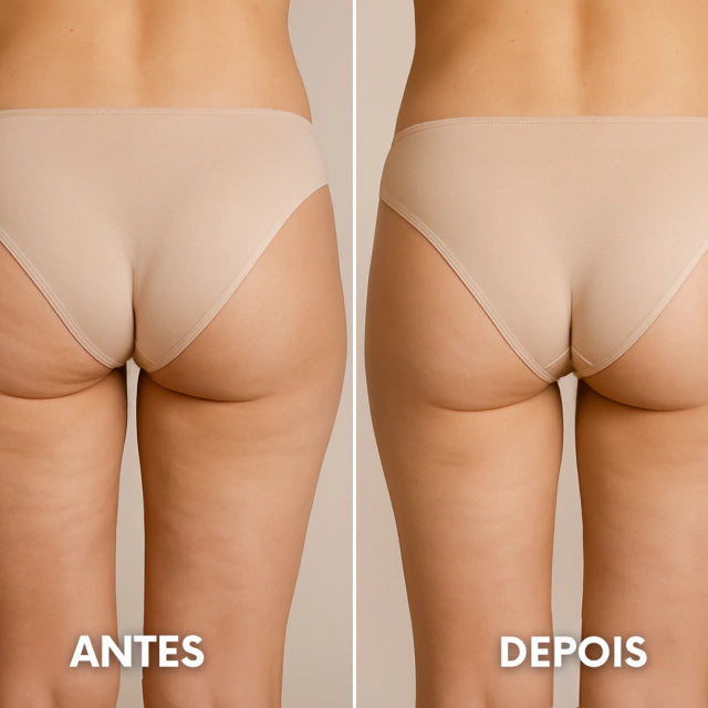 Aparelho Lipocavitação Ultrassônica Para Redução De Gordura E Celulite